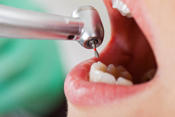 Best Emergency Dental Surgery in Chantilly, VA